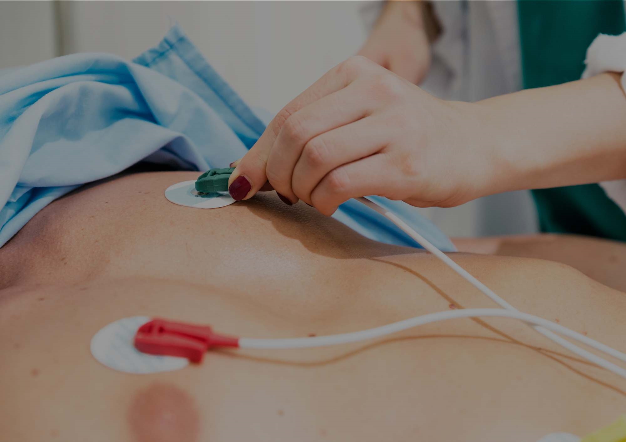 Electrocardiogram (ECG) Electrocardiogram (ECG)